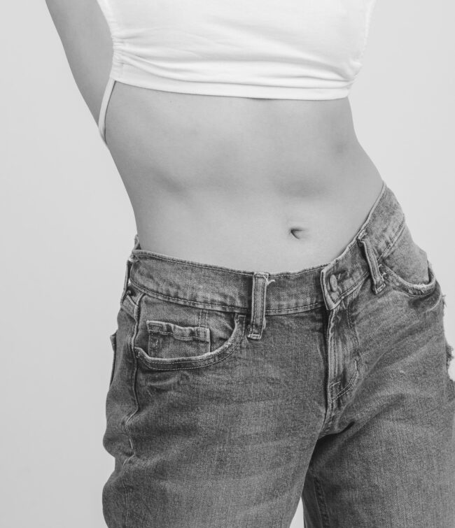 fleur de lis tummy tuck