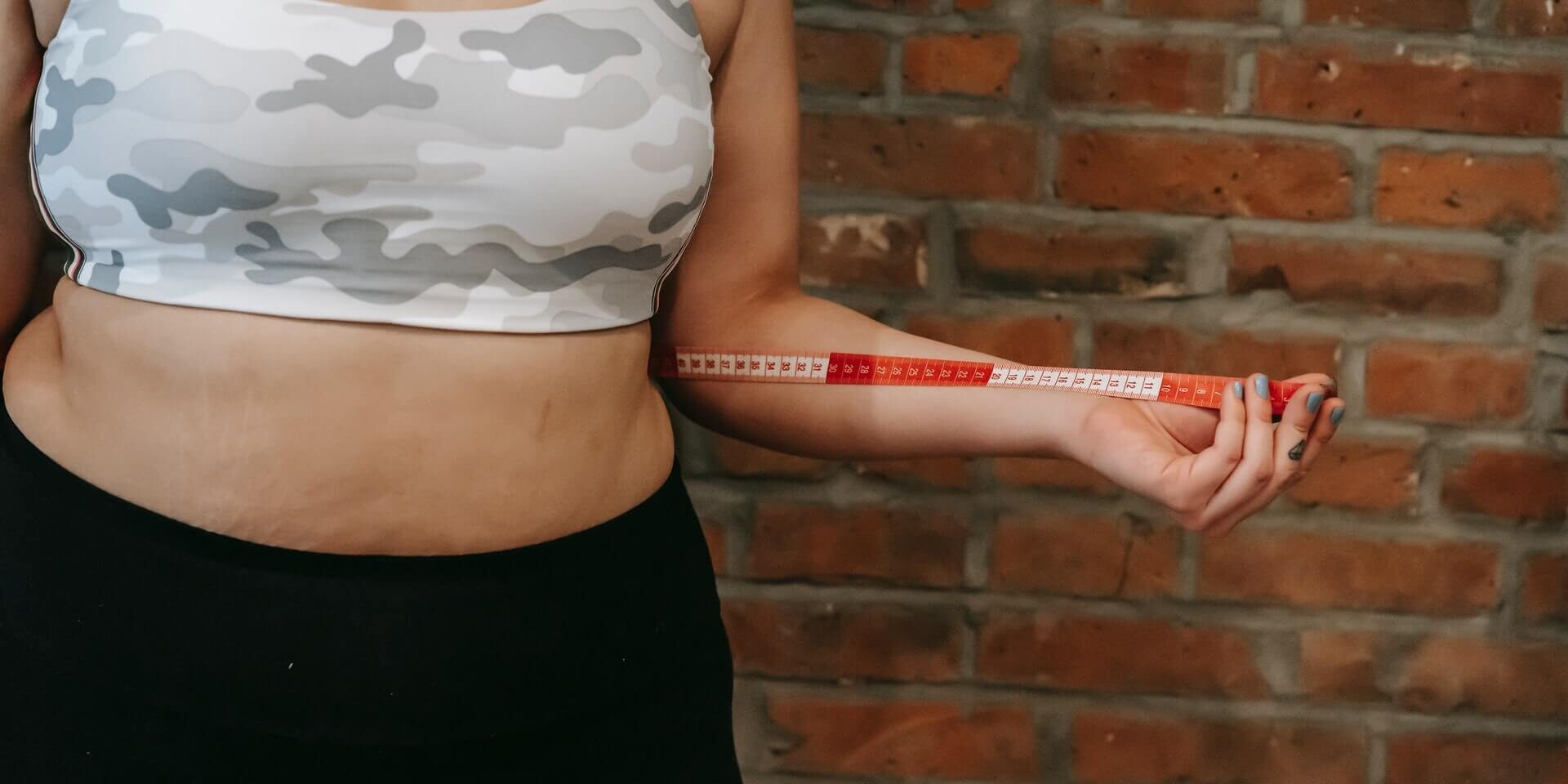 Life After Gastric Bypass