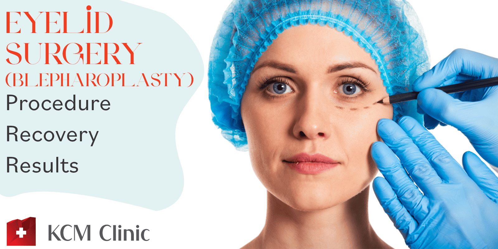 Eyelid Surgery (Blepharoplasty): Procedure, Recovery, Results - KCM Clinic