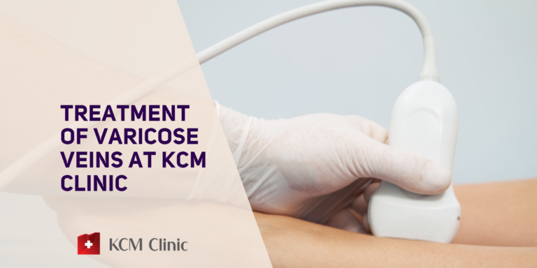 Treatment of varicose veins at KCM Clinic