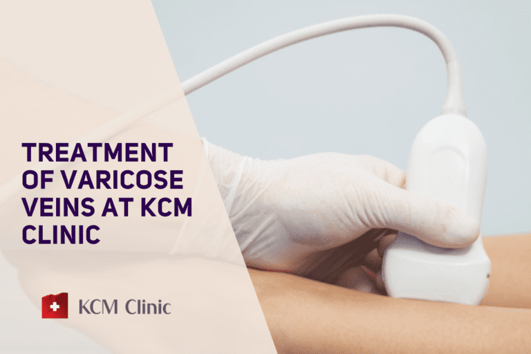 Treatment of varicose veins at KCM Clinic
