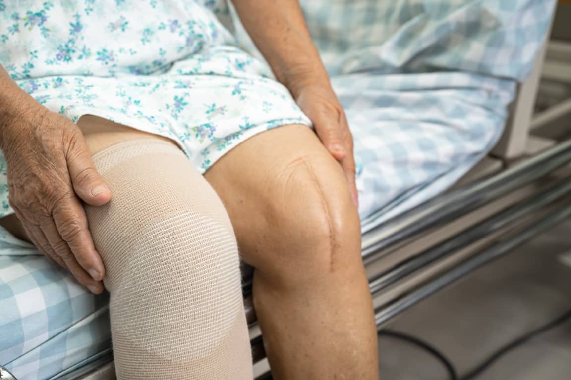 Top 10 Best Countries for Knee Replacement Surgery
